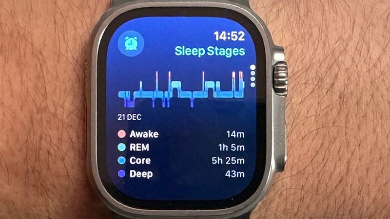 اپ Vitals اپل واچ